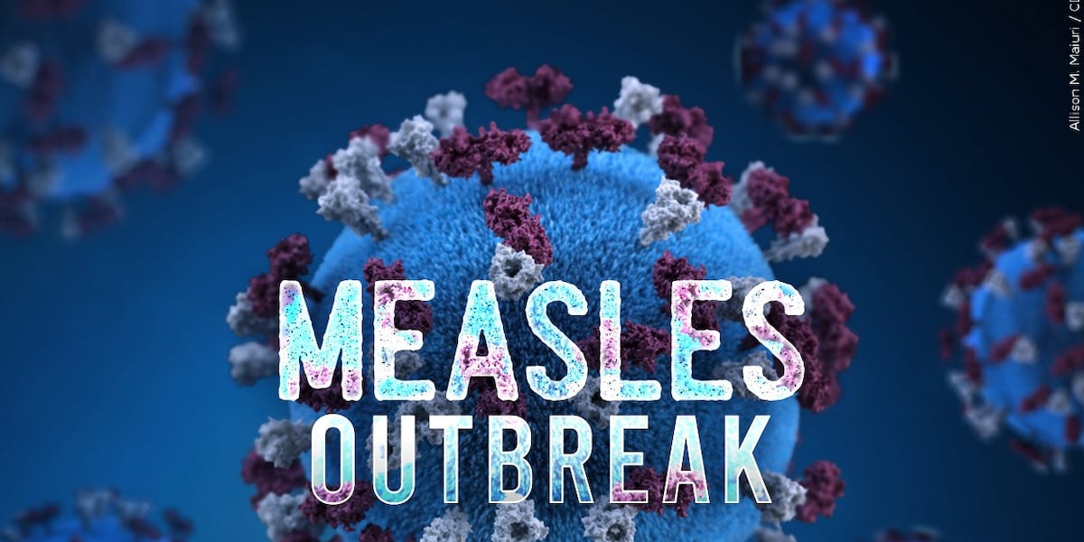 South Carolina measles outbreak reaches 789 cases, raising concerns about U.S. elimination status