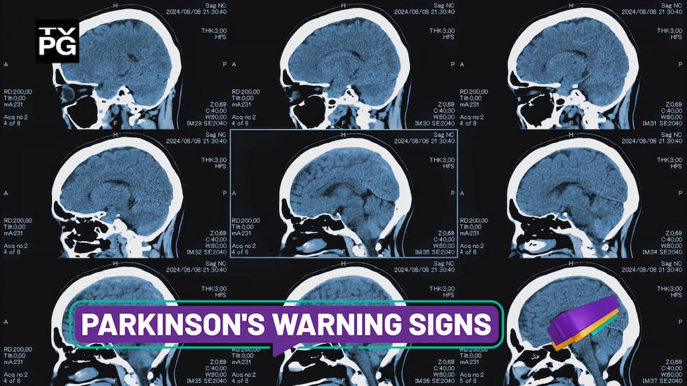 Parkinson's looks different in everyone and can start years before tremors show, with early...